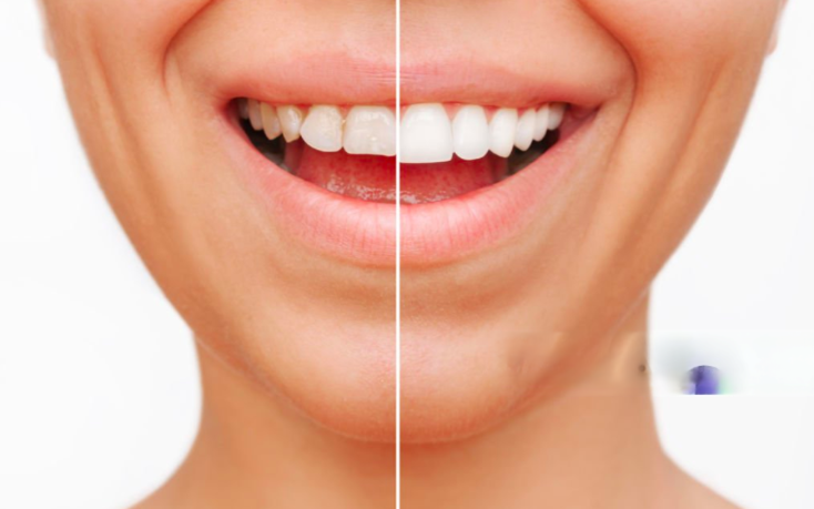 wmremove transformed