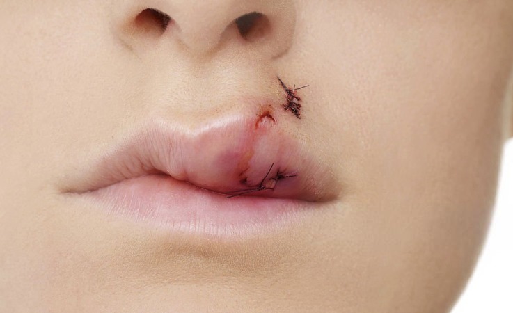 dewatermark.ai 1761298751535